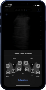 Butterfly iQ3™ Portable Ultrasound Device – 1 or 2 Probes