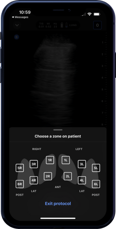 Butterfly iQ3™ Portable Ultrasound Device – 1 or 2 Probes