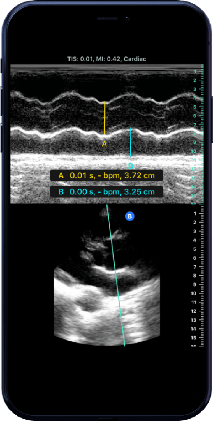 Butterfly iQ3™ Portable Ultrasound Device – 1 or 2 Probes