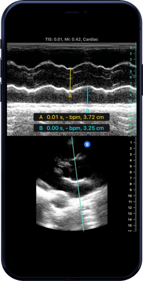Butterfly iQ3™ Portable Ultrasound Device – 1 or 2 Probes