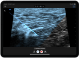 Butterfly iQ3™ Portable Ultrasound Device – 1 or 2 Probes