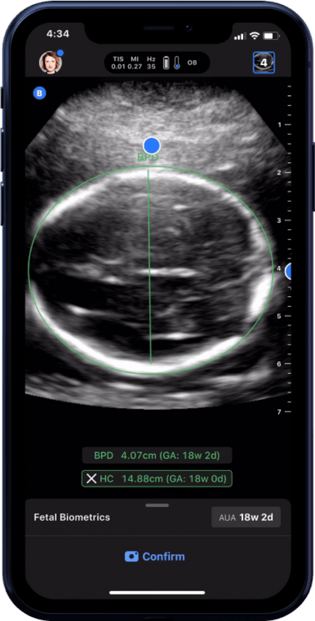 Butterfly iQ3™ Portable Ultrasound Device – 1 or 2 Probes