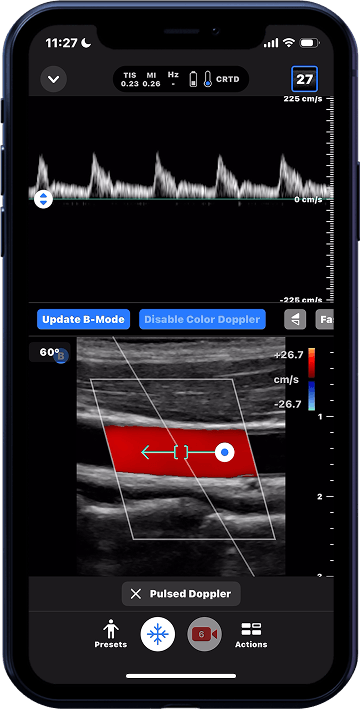 Butterfly iQ3™ Portable Ultrasound Device – 1 or 2 Probes