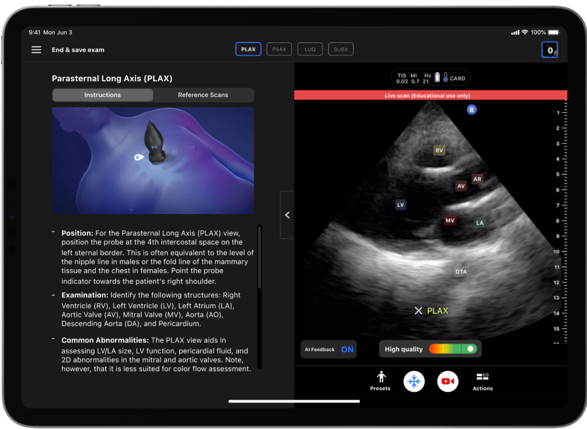 Butterfly iQ3™ Portable Ultrasound Device – 1 or 2 Probes