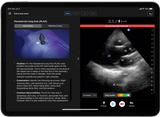 Butterfly iQ3™ Portable Ultrasound Device – 1 or 2 Probes