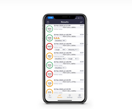 MIR Smart One Spirometer