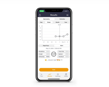 MIR Smart One Spirometer